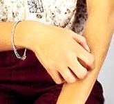 Cause della Dermatite da Contatto: allergia al nichel, al cromo e al cobalto; allergia al lattice e ai detersivi