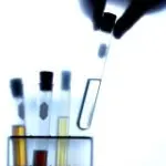 Cura dei noduli tiroidei e tumore della tiroide: la diagnosi con un esame del sangue