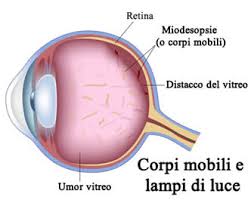Miodesopsie degli occhi: guarire dalle "mosche volanti"