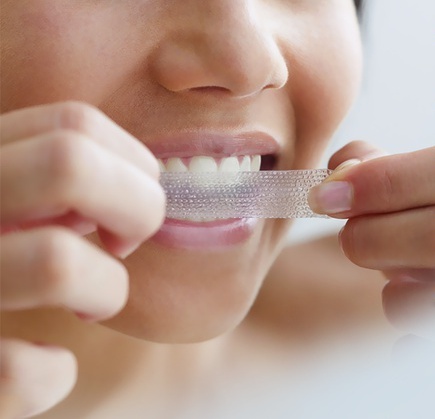 Strisce sbiancanti per denti in farmacia