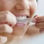 Strisce sbiancanti per denti in farmacia