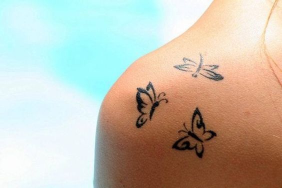 Come eliminare un tatuaggio: a chi rivolgersi?