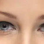 Botulino anti-rughe: effetti collaterali e controindicazioni