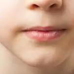 Dermatite atopica bambini e adulti: cause dermatite