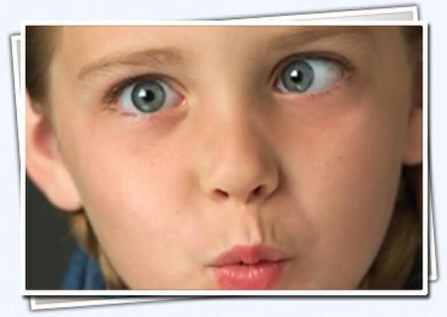 Strabismo: come riconoscerlo e curarlo