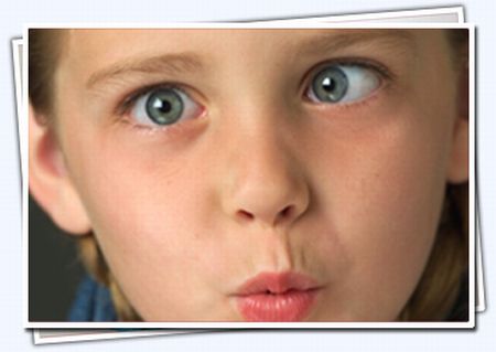 Strabismo: come riconoscerlo e curarlo