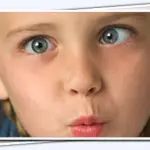 Strabismo: come riconoscerlo e curarlo