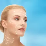 Soft lifting viso-collo con fili riassorbibili