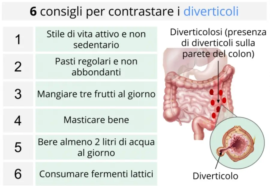 Diverticoli intestinali: sintomi, cura, dieta per diverticoli