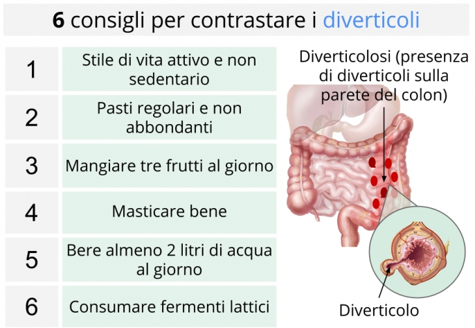 Diverticoli intestinali: sintomi, cura, dieta per diverticoli