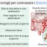 Diverticoli intestinali: sintomi, cura, dieta per diverticoli