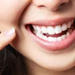 Implantologia dentale: tutto quello che devi sapere