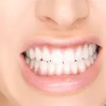 Bruxismo: che cos'è, come si riconosce e come si cura