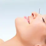 Agopuntura: benefici per ansia, stanchezza, memoria