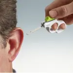 Orecchie a sventola: correzione mini-invasiva 