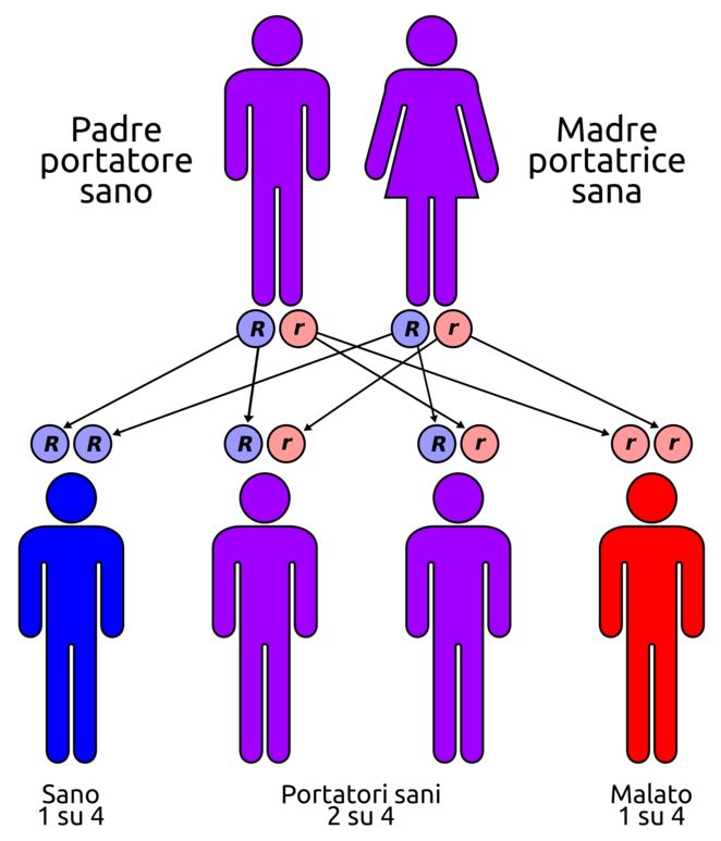 Malattia di Pompe: malattie genetiche rare