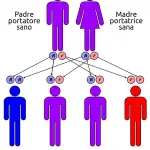 Malattia di Pompe: malattie genetiche rare