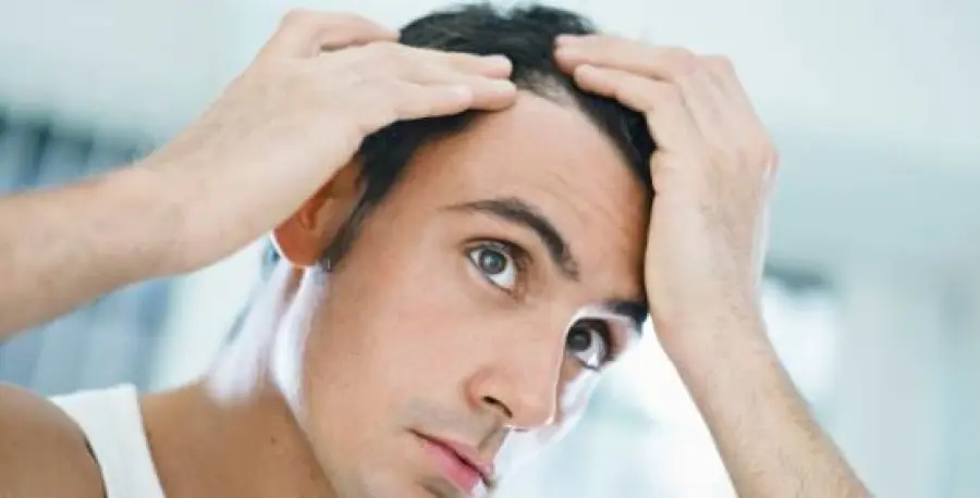 Trapianto capelli per calvizie: come funziona