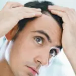 Trapianto capelli per calvizie: come funziona