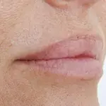 Pelle secca: rimedi naturali efficaci