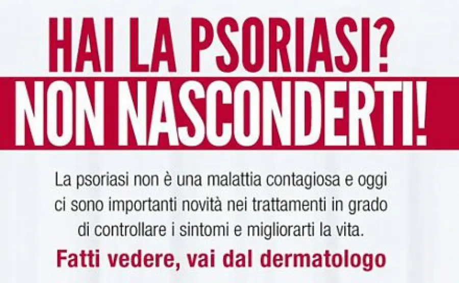 Cause psoriasi pelle: farmaci per la cura