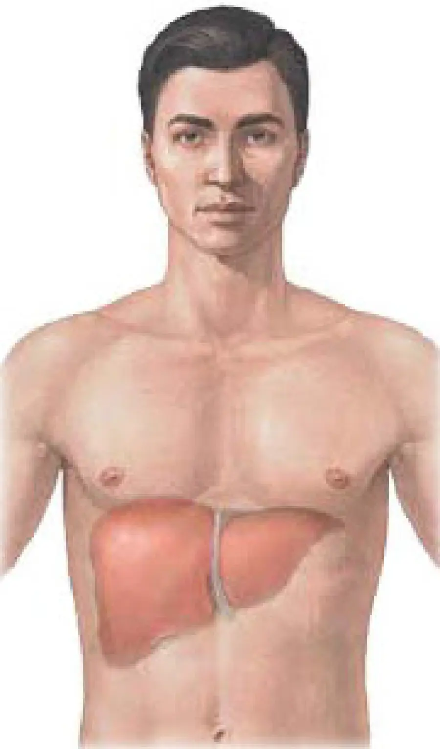 Cirrosi epatica e tumore al fegato: fattori di rischio