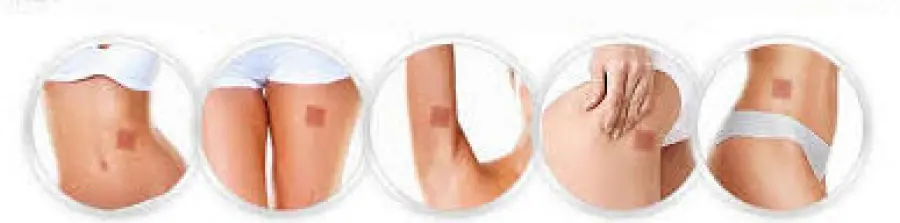 Cerotti dimagranti efficaci: come funzionano