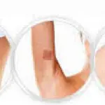 Cerotti dimagranti efficaci: come funzionano