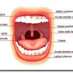 Cause tumore bocca: cura tumore lingua-palato