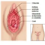 Infezioni vaginali: cause bartolinite, sintomi, terapia di cura