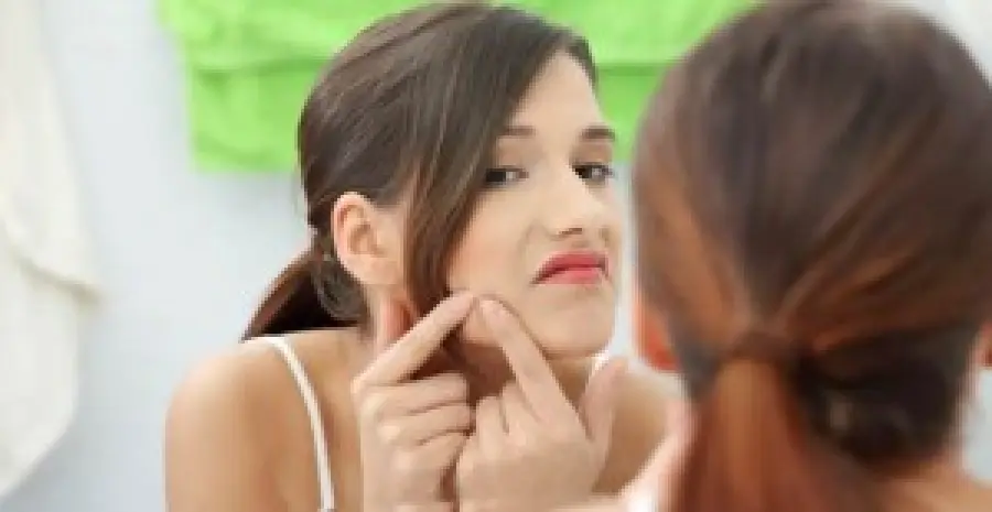 Pelle grassa, acne, brufoli: rimedi naturali efficaci fai da te