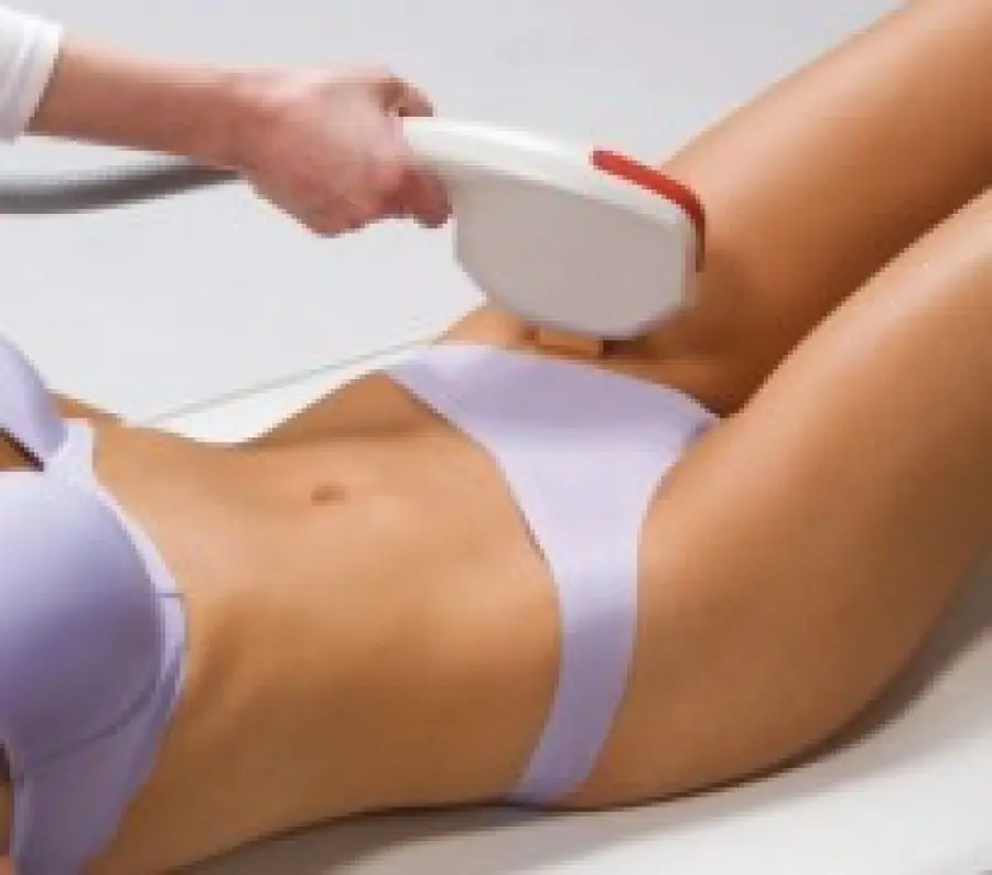 Come funziona la depilazione laser definitiva: luce pulsata, laser a diodo e alessandrite