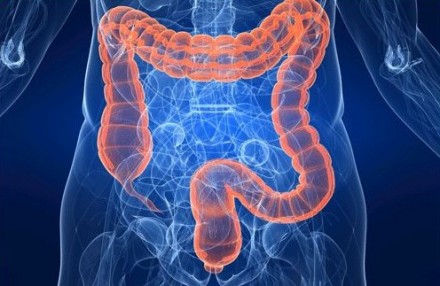 Cause rettocolite ulcerosa: malattia cronica intestinale. Sintomi, diagnosi e terapie di cura