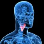 Malattie della tiroide: ipotiroidismo, ipertiroidismo e tumore della tiroide. Sintomi e cura