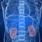 Sintomi insufficienza renale: diagnosi, cura e dieta per l' insufficienza renale