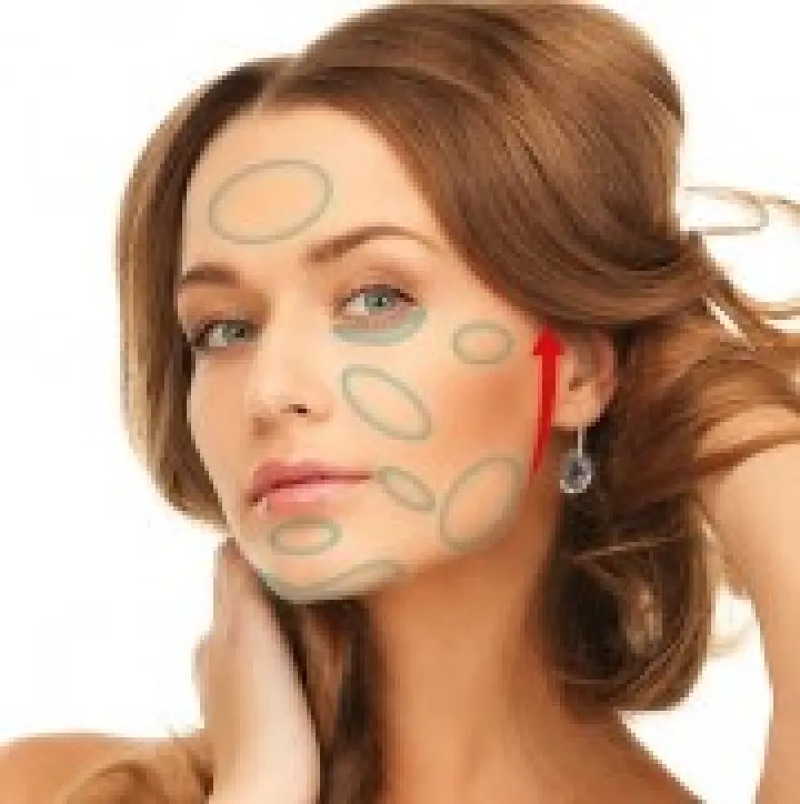 Fili riassorbibili per rassodare viso, collo, interno braccia, interno cosce. Medicina Estetica