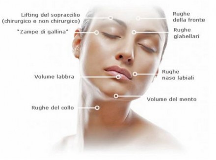 Rughe viso: acido ialuronico, botulino e laser per eliminare le rughe del viso
