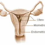 Polipi uterini: diagnosi e cura polipi dell' utero. L' intervento chirurgico
