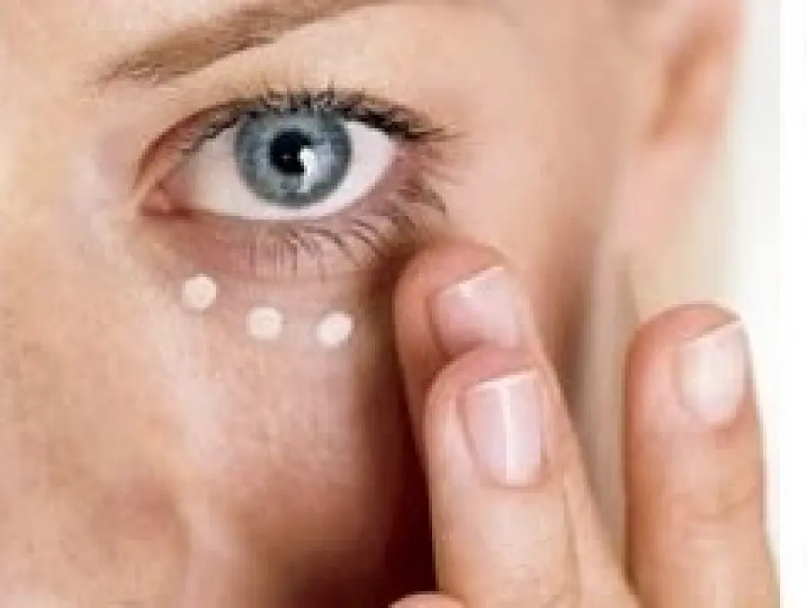 Eliminare occhiaie con filler di grasso corporeo prelevato dal paziente: cellule staminali concentrate