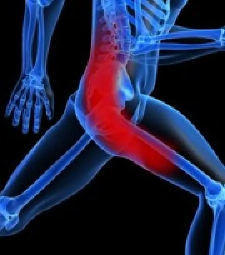 Mal di schiena da sciatica: rimedi di cura con ozonoterapia e auricoloterapia (agopuntura)