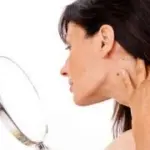 Nei maligni della pelle: mappatura dei nei per prevenire il melanoma (tumore pelle)